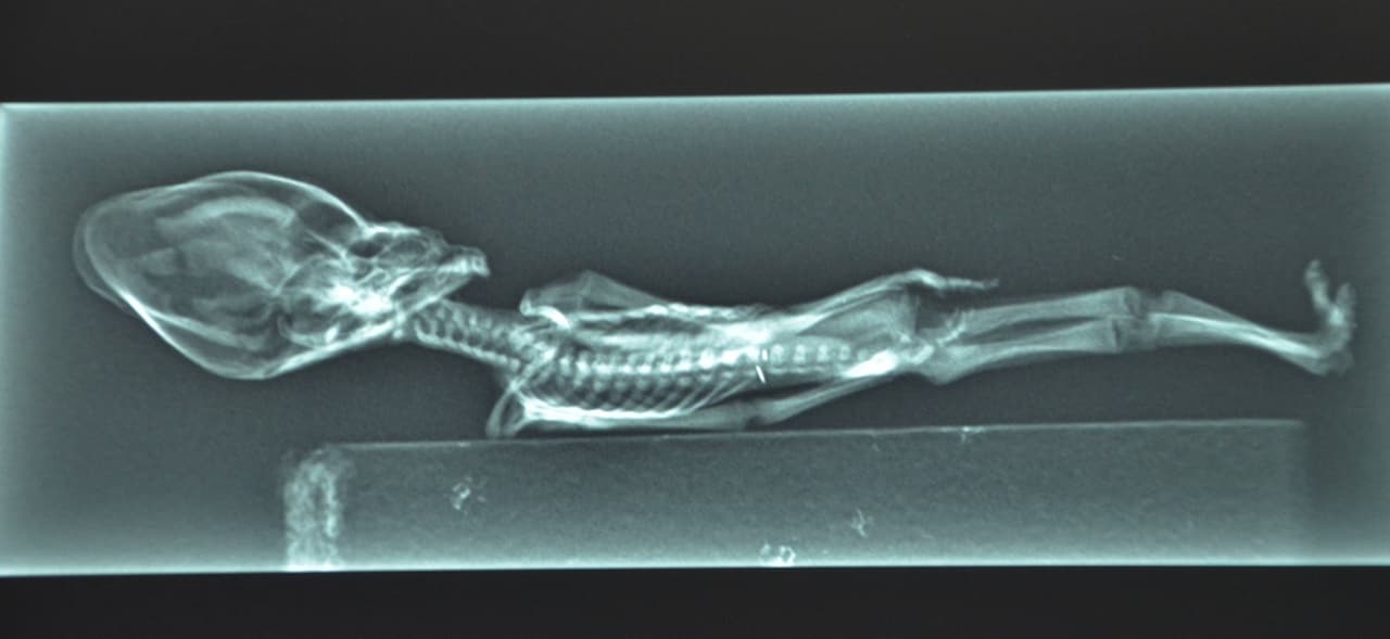 alien-x-ray-2