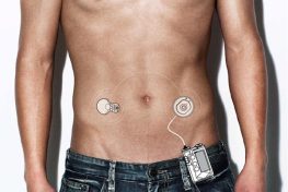 Robotic Pancreas Makes Diabetes Sufferers Into Cyborgs