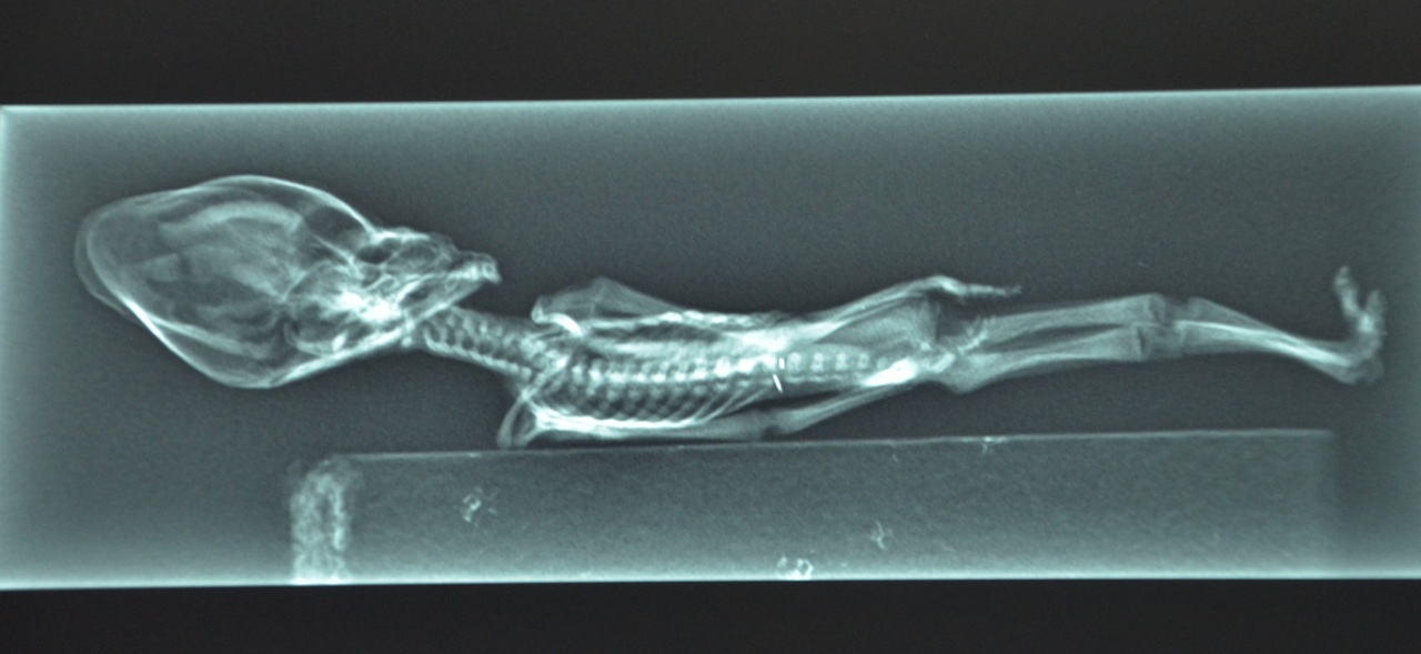 Is Greer's Sirius alien real? 5 alien-x-ray-2