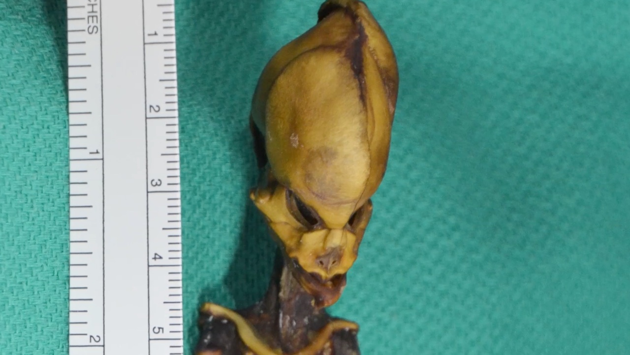 Is Greer's Sirius alien real? 3 tiny-alien-skull-2