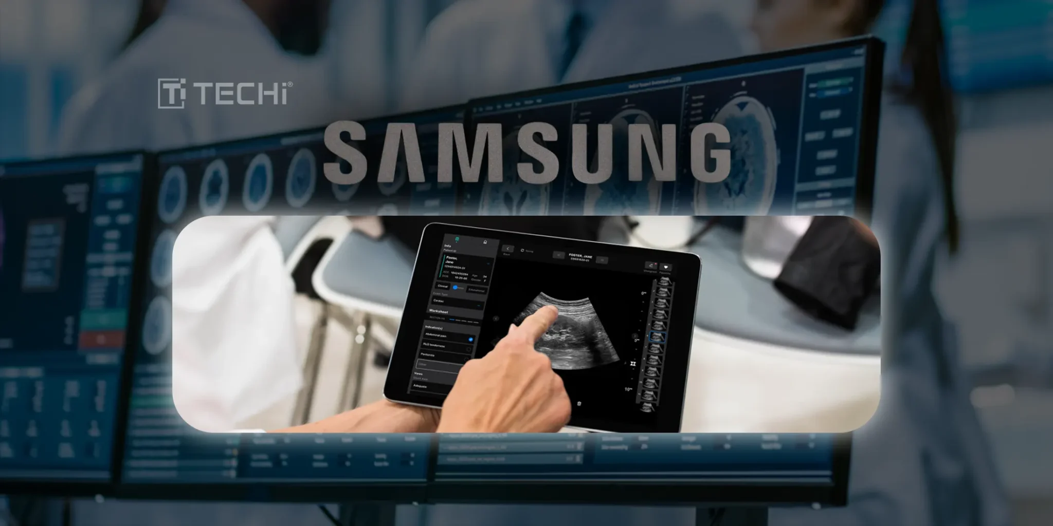 Samsung Plans to Invest $100 Million in Exo, an AI-Powered Medical Imaging Startup